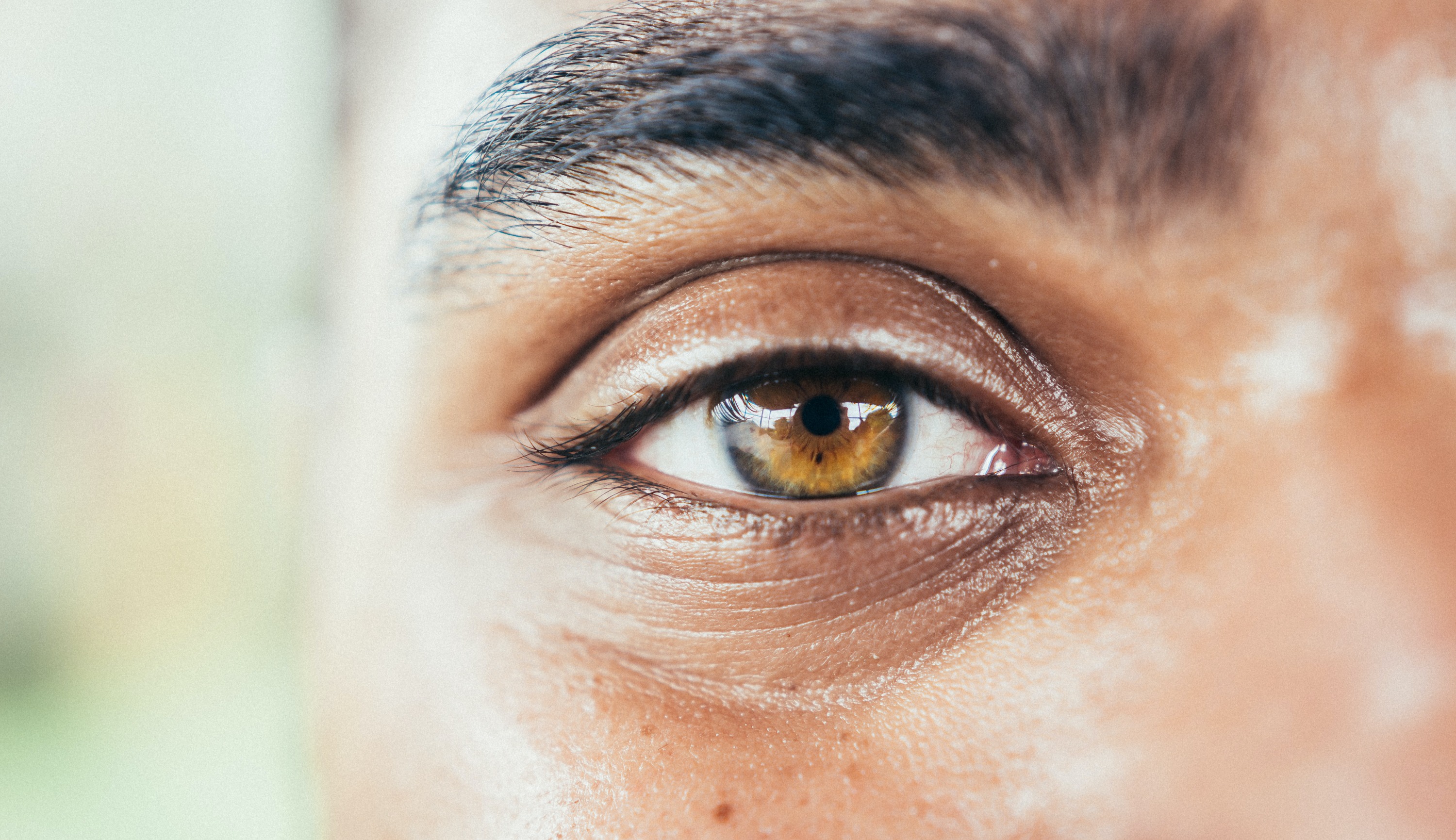 Get Rid of Your Under-Eye Bags for Good!