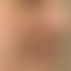 Episode 4: Not Your Average Facial Flushing