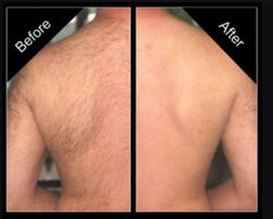 before and after