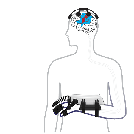How the IpsiHand Works