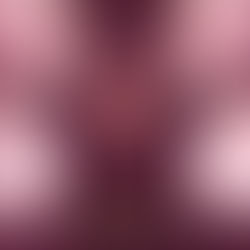 A tree with chains around its branches.