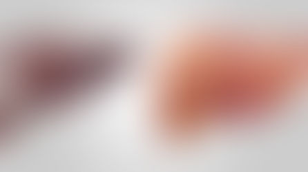 Healthy liver, smooth and brown, contrasted with a rough, bumpy cirrhotic liver.