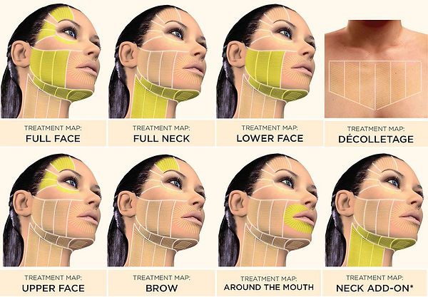 ultherapy.jpg
