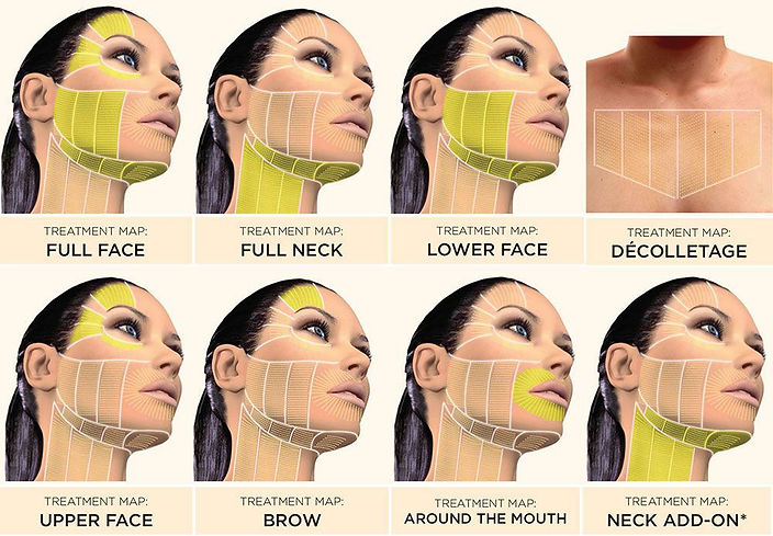 ultherapy.jpg