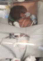 CPAP prone miror_edited
