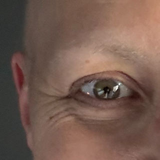 Eye brows after 16 rounds of chemo