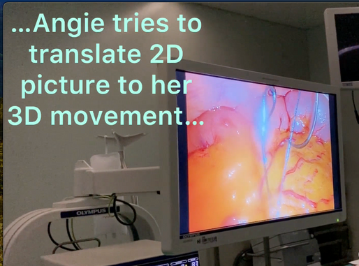 Angie threats the needle