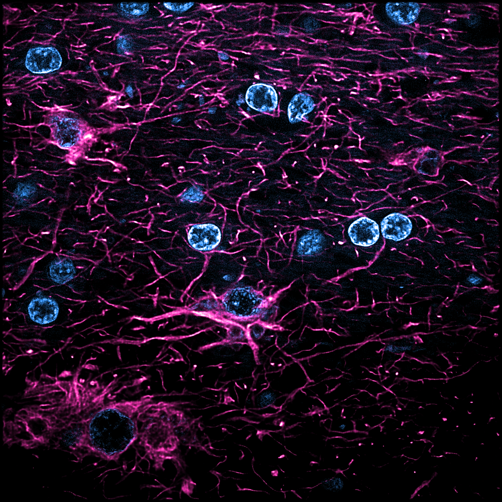 Brain 2 13 processed.png