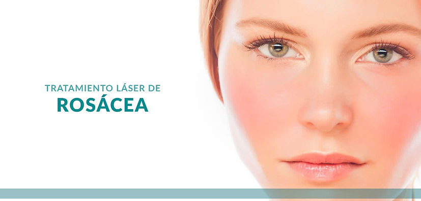 rosacea.jpeg