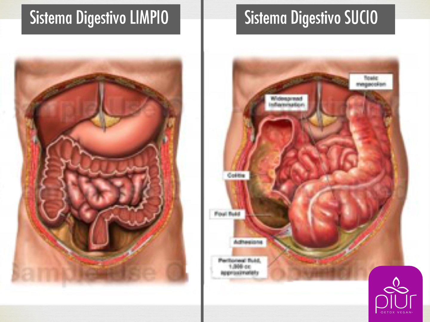alimentos para colon sano