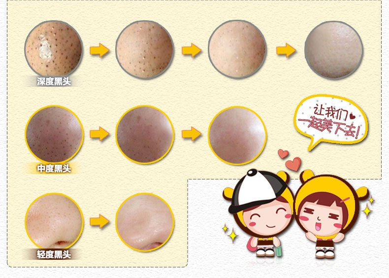 Miniatura: Rorec Nose Pack 3 Step