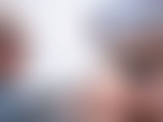 Sculptra til opstramning af hud og forbedring af hudens fasthed