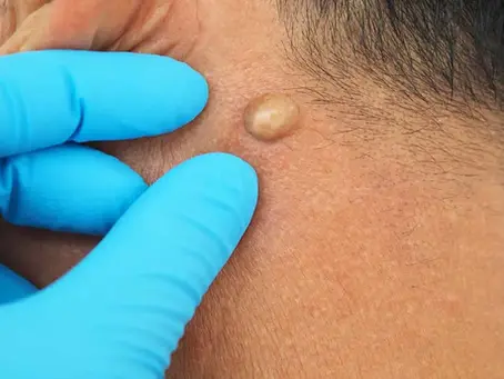 FREE Consultations Still Available!