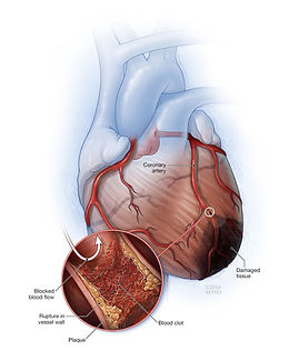Heart smoking.jpg
