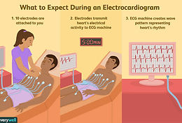 ECG Animation.jpg