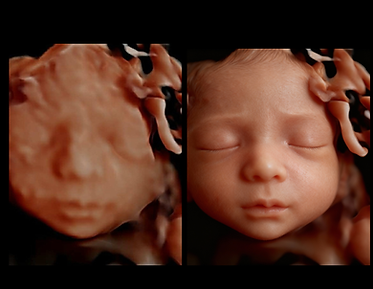 Side-by-side image of a baby’s ultrasound showing the difference between the original scan and the 8K enhanced version.
