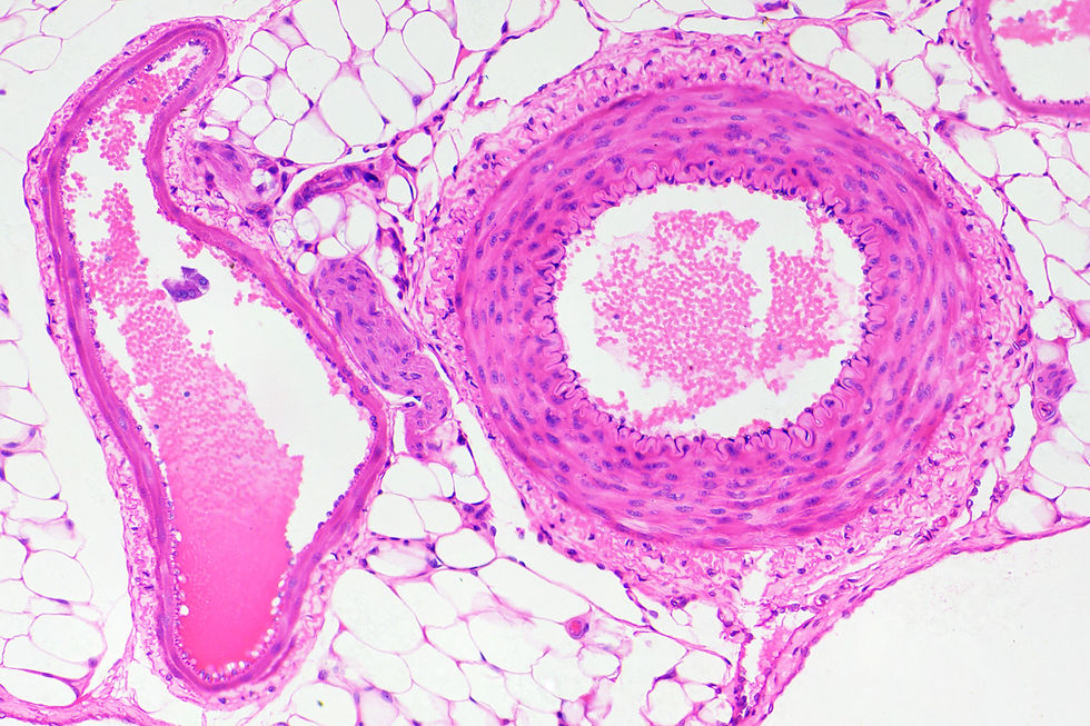 Microphotographie d'une veine à gauche et d'une artère à droite