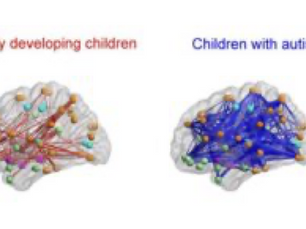 Understanding neurodiversity