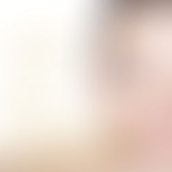 Is Hyaluronic acid the New Botox