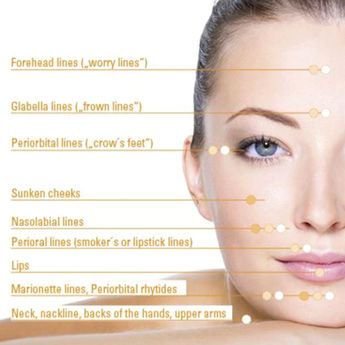 Is Hyaluronic acid the New Botox