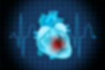Heart sound recorder