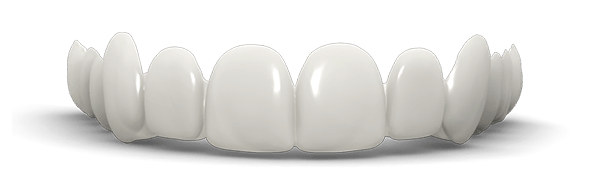 Lentes de contato Dental