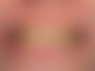 How Can I Prevent Teeth Stains?