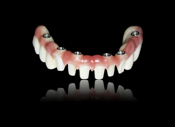 K-11010 CADCAM Zirconia Implant Bridge