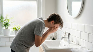 Teen Skincare Routine for Acne-Prone Skin