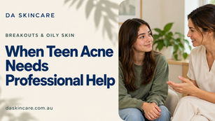 When Teen Acne Needs Professional Help