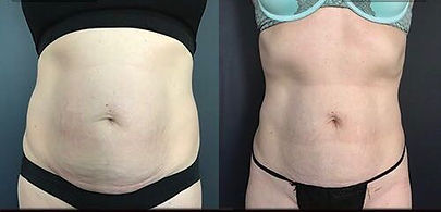 WhatsApp Image 2018-10-08 at 5.00.29 PM(