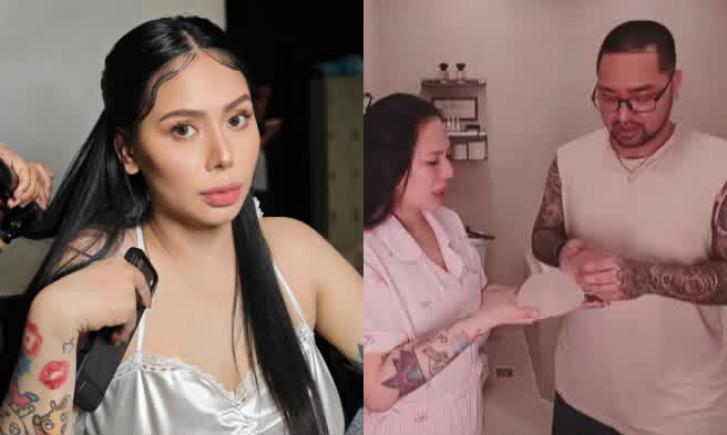 BULGARY - TONI, IPINATANGGAL NA ANG SILICON SA SUSO-FB Toni Fowler.