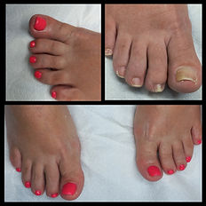 feet care grantham