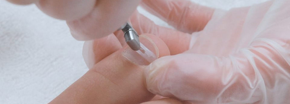 Nail Bracing for Ingrown Toenails