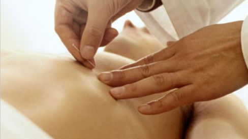Curso de Acupunctura