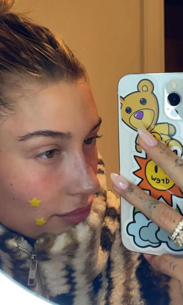 Miniatura: Parches de estrella 40p