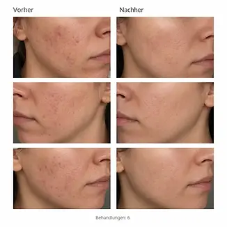 Vorher nachher bilder