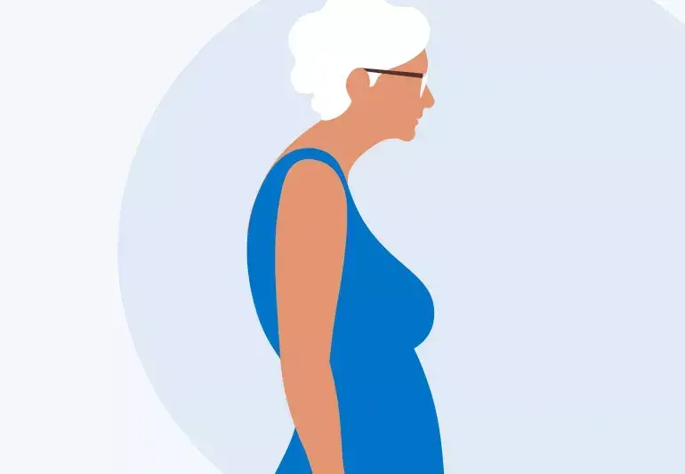 dowager-Hump-1345936354-770x533-1_jpg.webp