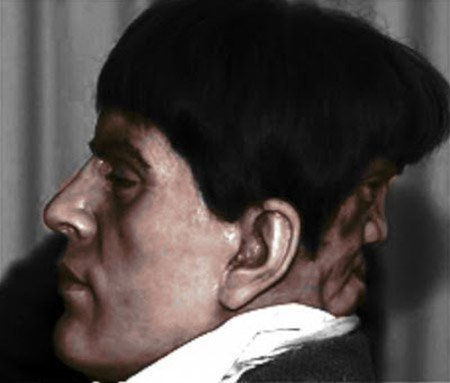 A Medicina do passado em 10 fotos - EXCLUSIVO