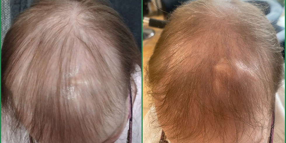 Vorher-Nachher Vergleich einer stark ausgedünnten Haarpartie. Links sichtbar ausgedünnten Haarpartie