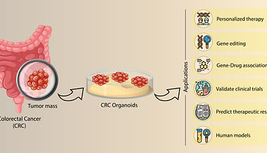 CRC Organoids_300x-100.jpg