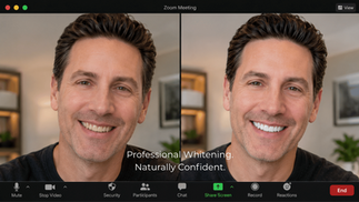 Zoom Whitening Before and After: What to Expect, Results, and Patient Experiences
