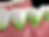 3D medical illustration of teeth with green stains along the gum line, caused by plaque buildup, poor oral hygiene, and chromogenic bacteria.