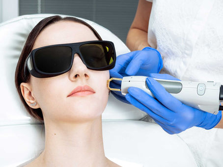 Laser Pigmentation Removal- How Does it Work?