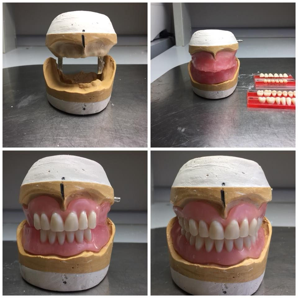 midland denture clinic