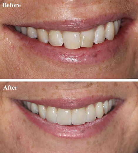 merrion road dental