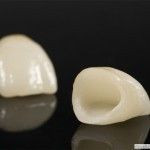 Dental prosthetics 3 (dental services)