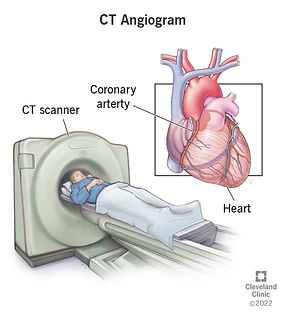 16899-ct-angiogram.jpg