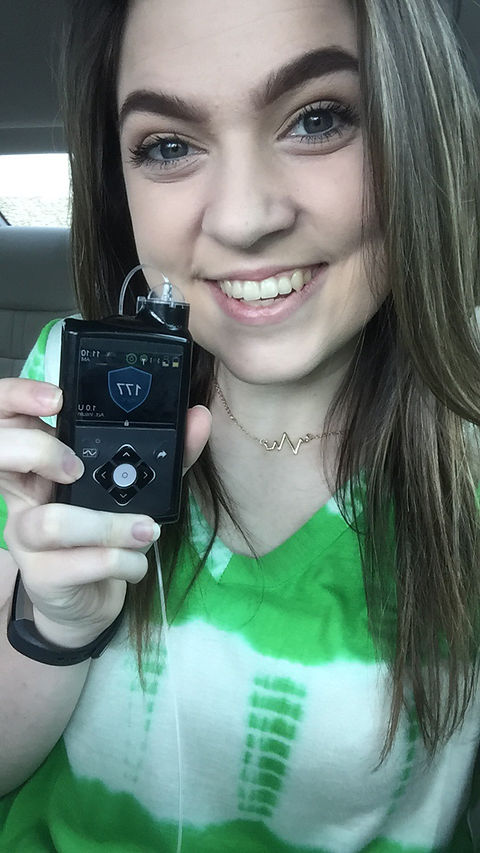 The 670g insulin pump in auto mode.
