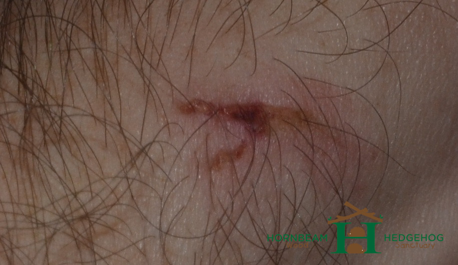 An adult hedgehog bite